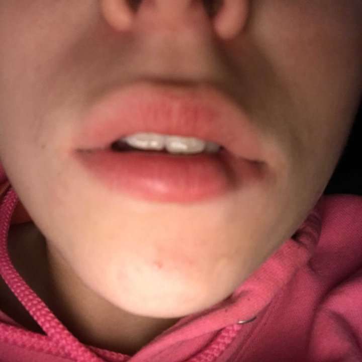 amputatee's profile photo